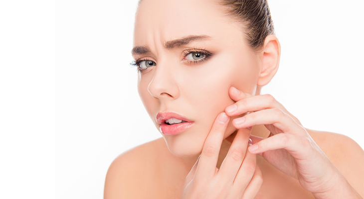 how to get rid of acne