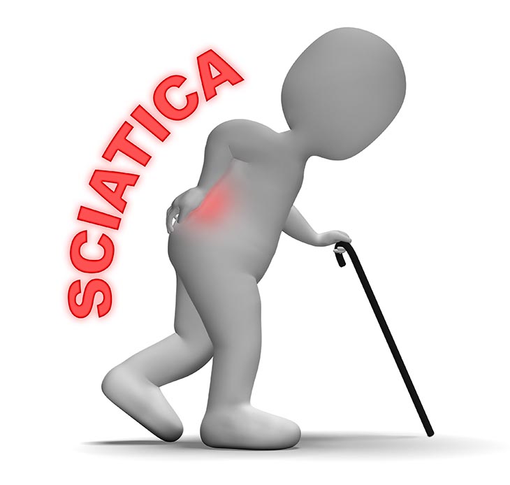 best seat cushions for sciatica