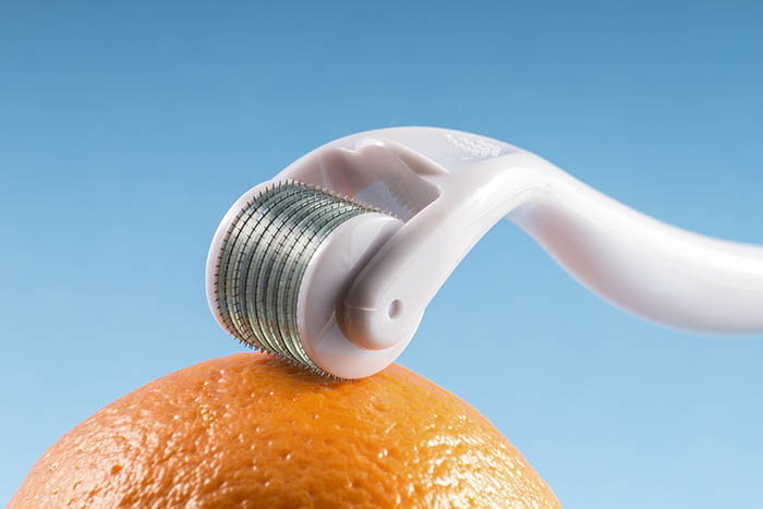 derma roller 1.0
