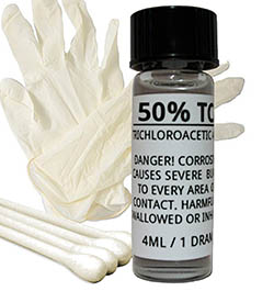 50% TCA Home Skin Peel Kit