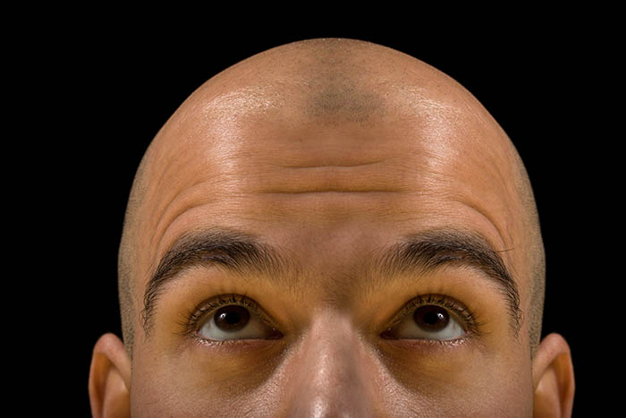 best sunscreen for balding head