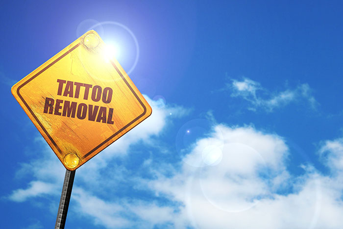 tattoo removal cream that works