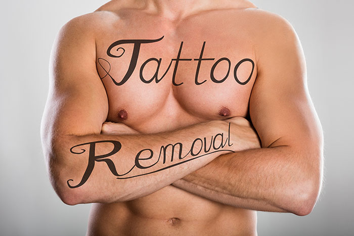 tattoo removal creams that work