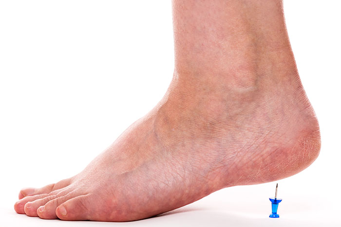 best arch support socks