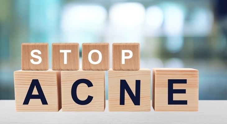 prescription treatment for acne