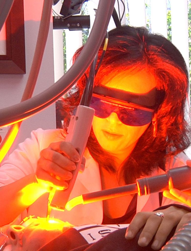 Laser Acne - Procedure