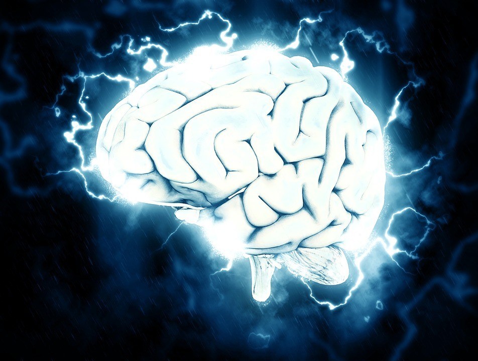 Nootropic Supplements